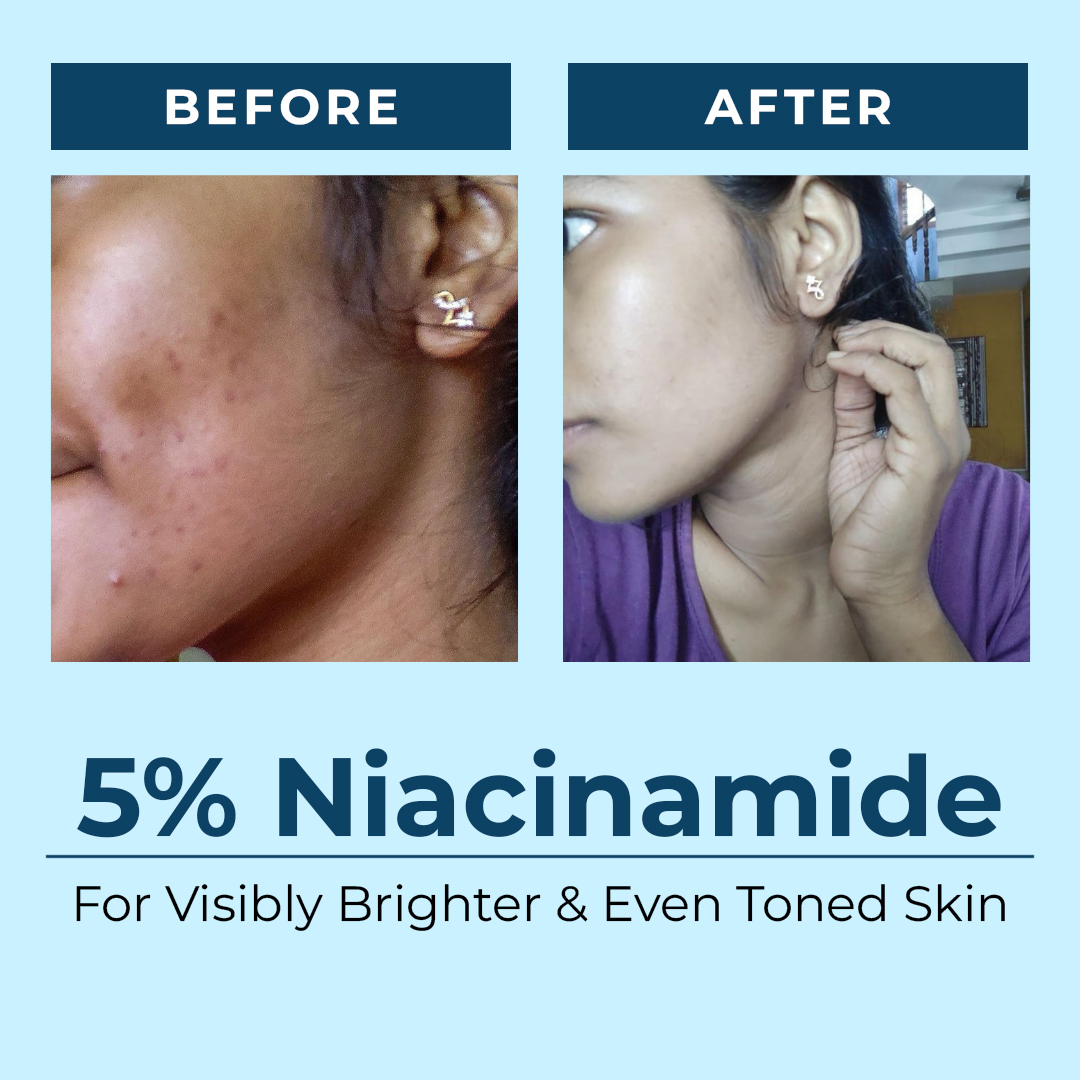 SeaBoost Pigmentation Clearing Serum