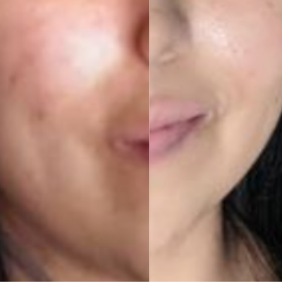 Before and After