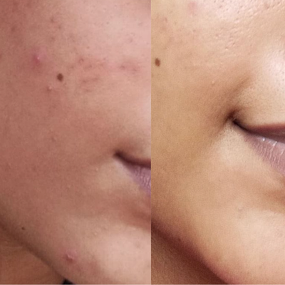 Before and After